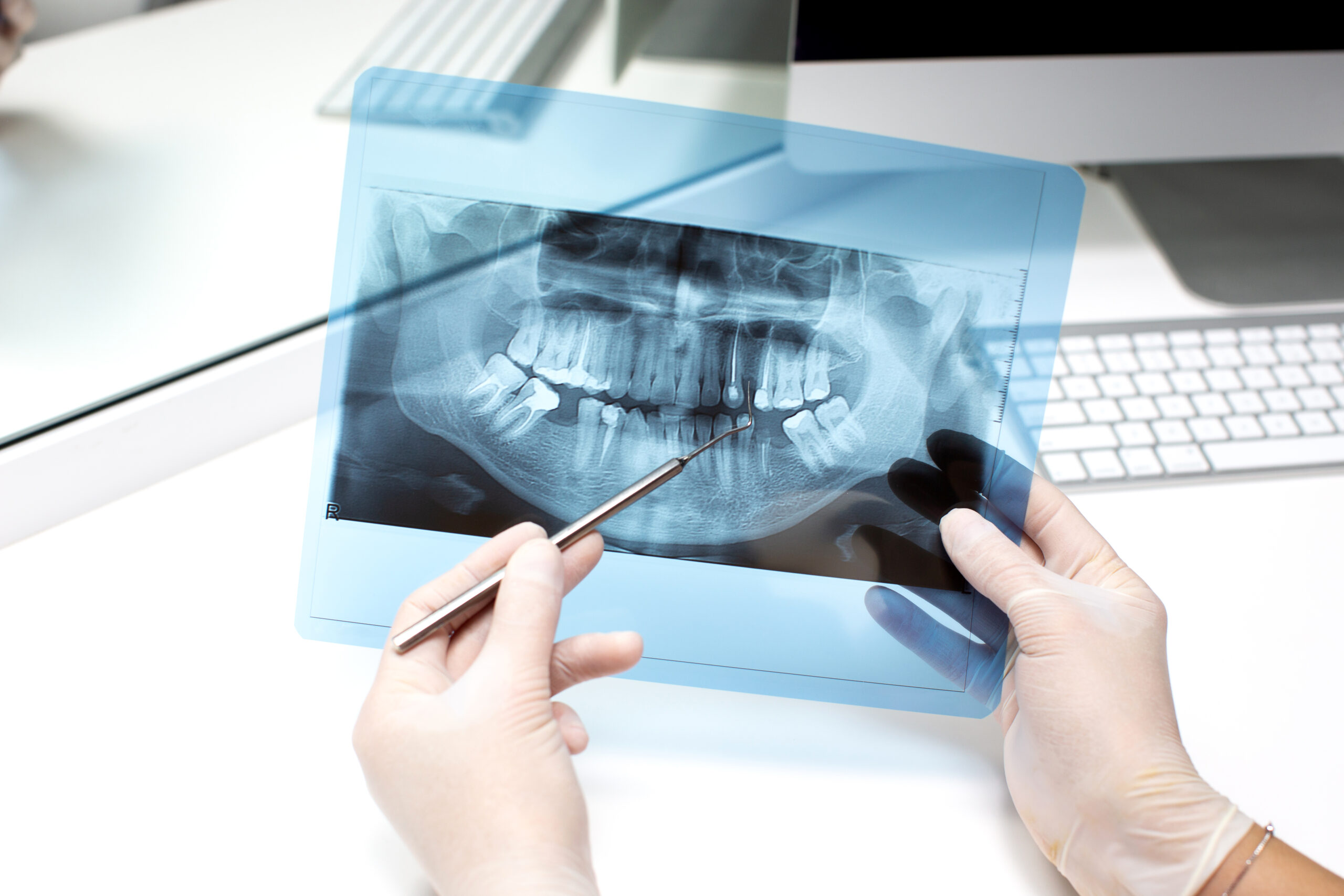 Dentist showing a young patient their dental X-ray during a consultation inside a modern clinic.